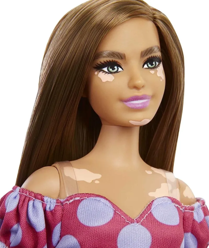 barbie_fashionistas_vitil_2.webp Barbie Fashionistas Vitiligo Doll 171 Brunette Hair Discount